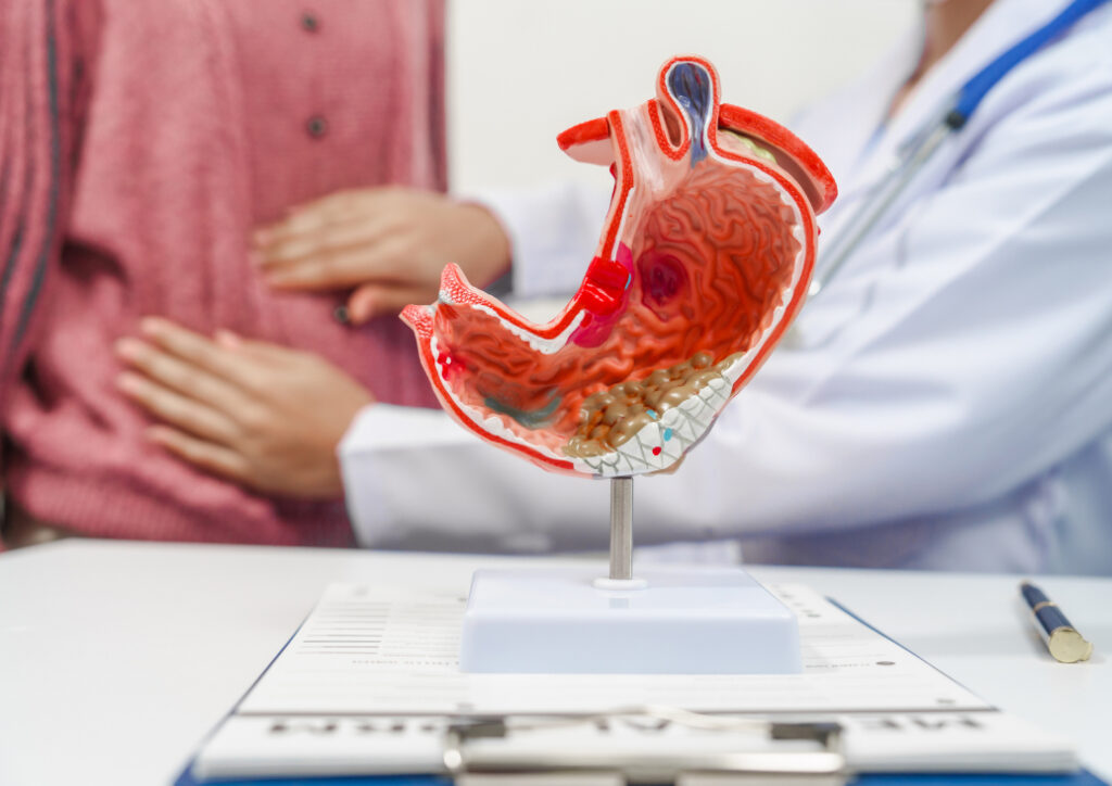 Laparoscopic Cholecystectomy indications